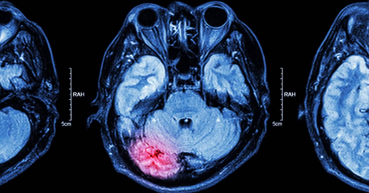 Two Types of Head Injury | Colling Gilbert Wright